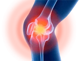 Ilustração do produto Nautubone gel