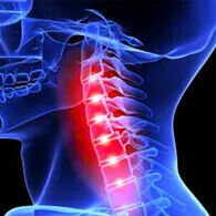 Nautubone za cervikalnu bol